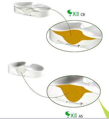 CoCrMo SKII Tibial Tray Artificial Knee Joint