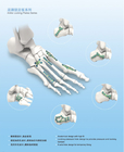 ISO 13485 Type I LCP Plate Ortho For Calcaneus Fracture