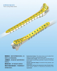Plate and Screw Tibial Platform Medial Plates I (L/R) Lower limbs Titanium Implant
