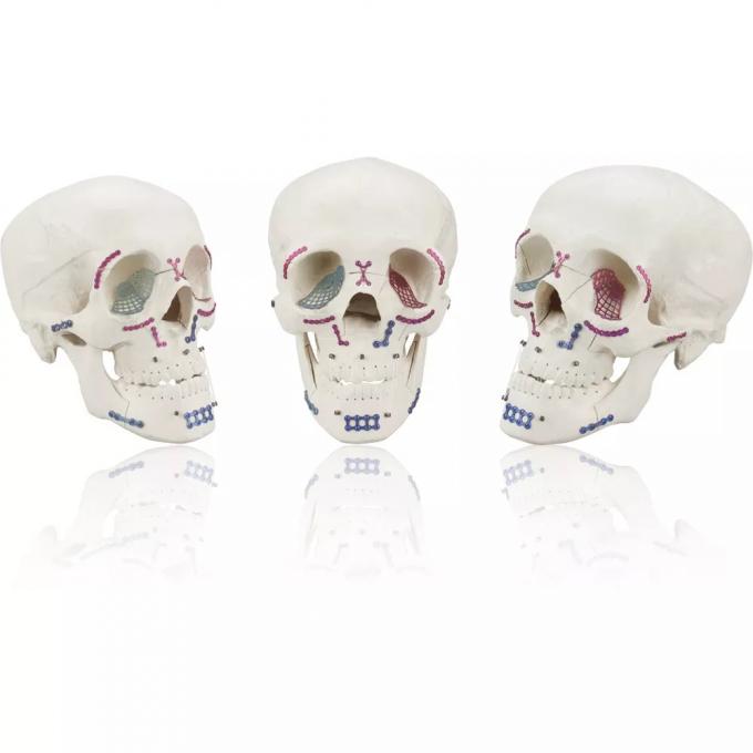 Maxillofacial Mini Locking L Plate 1.0mm System Thickness Titanium 2
