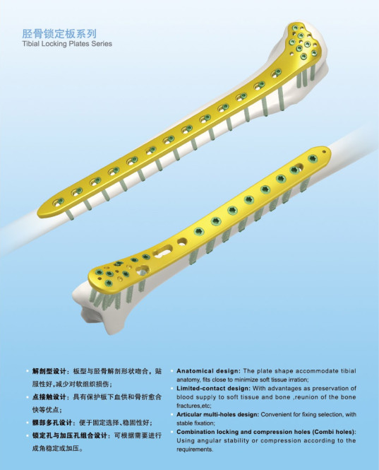 Plate and Screw Lag Screw Titanium Implant use with Proximal Femur Plates 1