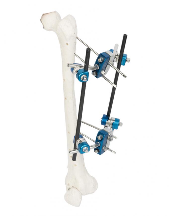 Lower Limbs Orthopedic Schanz Pin External Fixation CE ISO9001